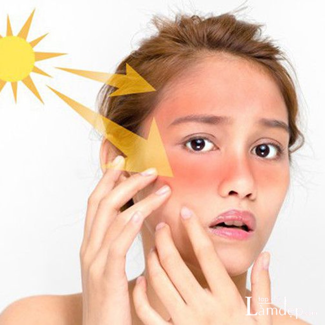 Tia cực tím từ mặt trời gây tác hại cho da