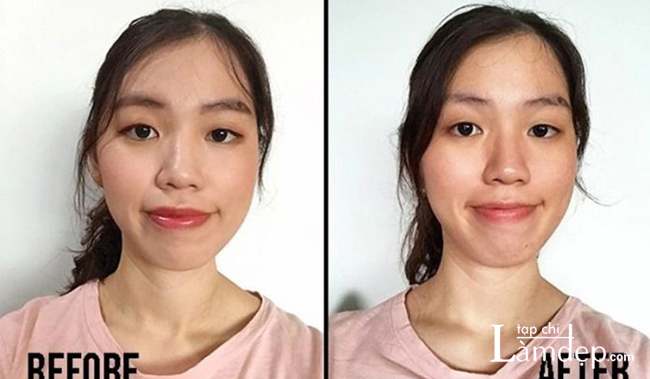 Vivian trước và sau khi sử dụng Bioderma Sébium H2O Micellar Water với một miếng bông cho toàn bộ khuôn mặt (trừ vùng mắt và môi)