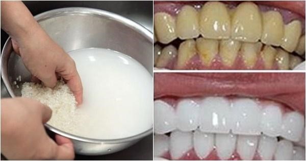 Làm trắng răng tại nhà bằng nước vo gạo